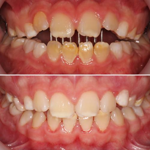 Ortodontia e Odontopediatria - Drª Joana Soares